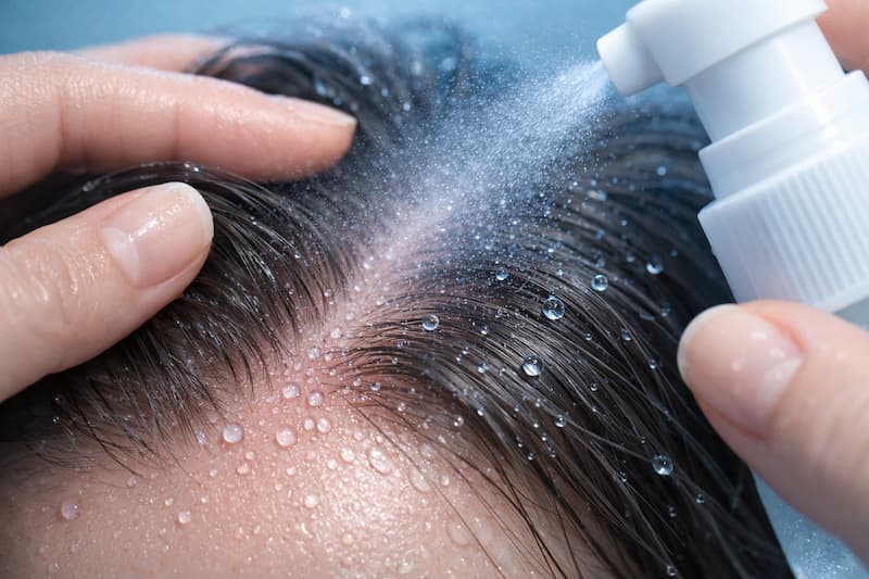 itchy dry scalp diy fixes